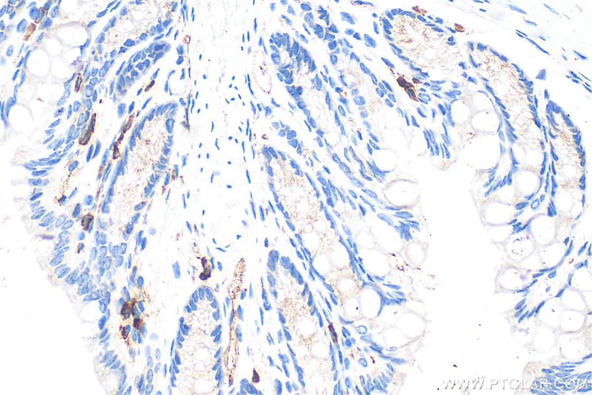 Immunohistochemistry (IHC) staining of mouse colon tissue using SLAMF6 Polyclonal antibody (33396-1-AP)