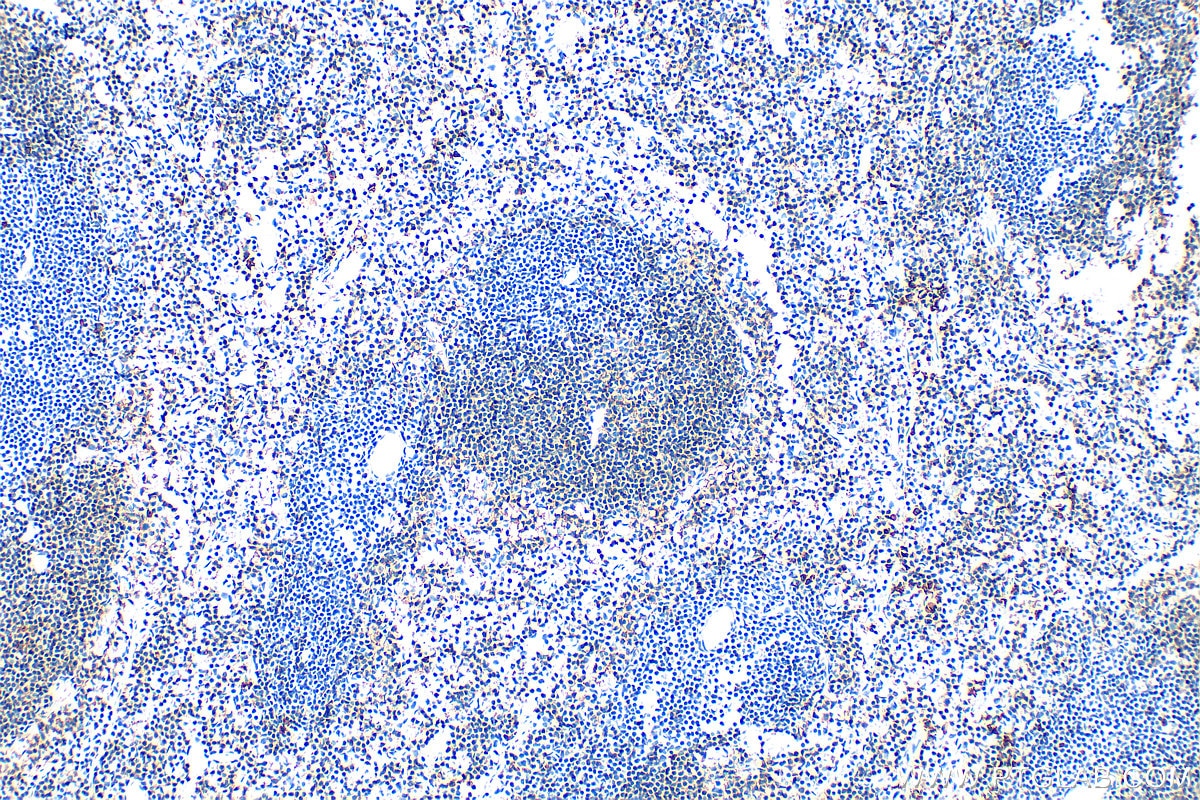 Immunohistochemistry (IHC) staining of mouse spleen tissue using SLAMF6 Polyclonal antibody (33396-1-AP)