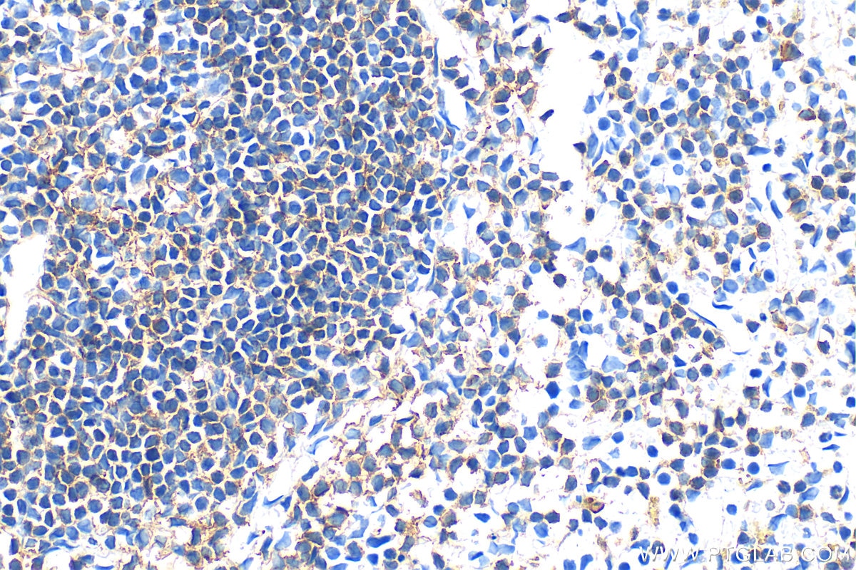 Immunohistochemistry (IHC) staining of mouse spleen tissue using SLAMF6 Polyclonal antibody (33396-1-AP)