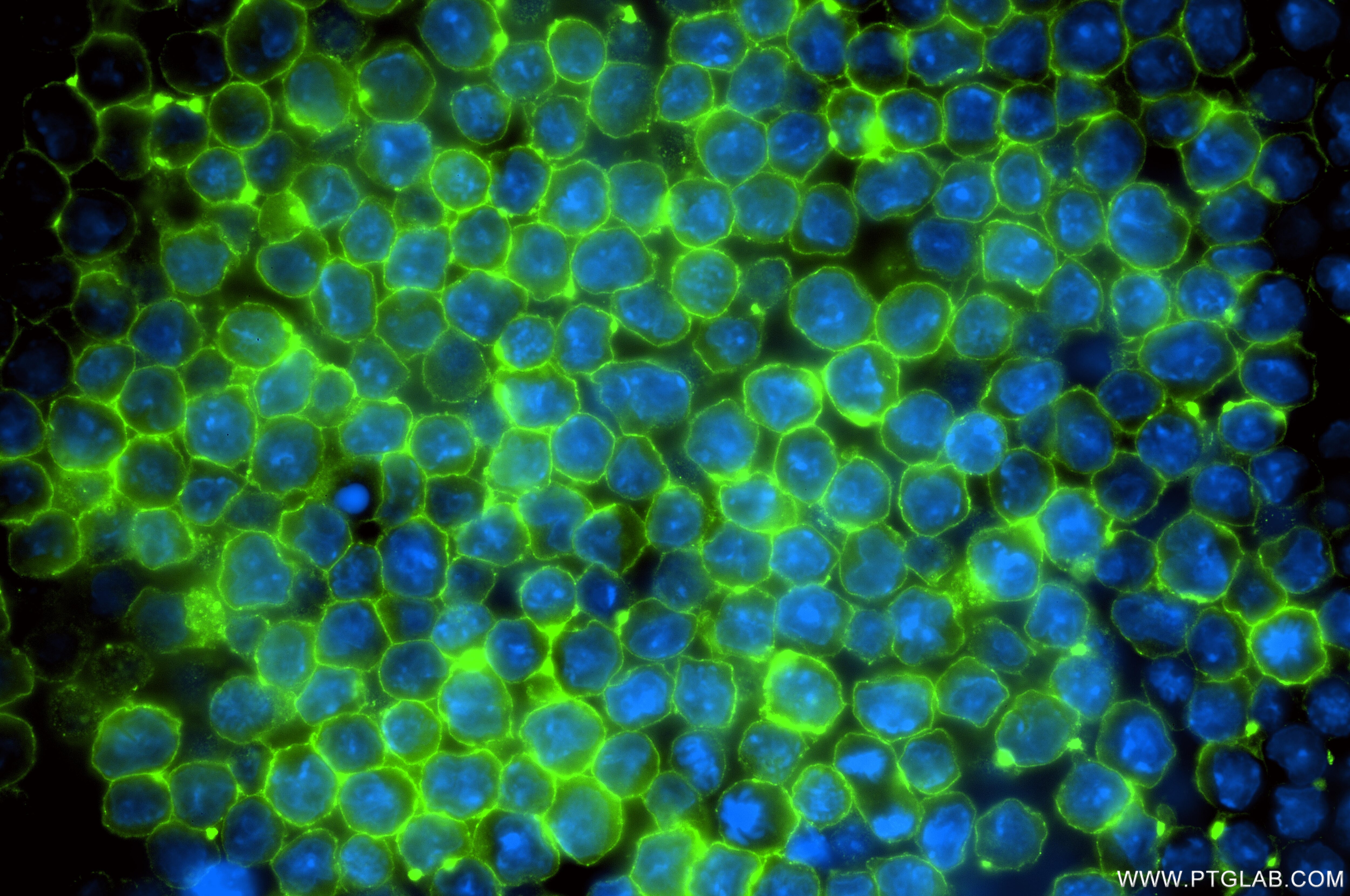 Immunofluorescence (IF) / fluorescent staining of A20 cells using SLAMF6 Recombinant antibody (86422-1-RR)