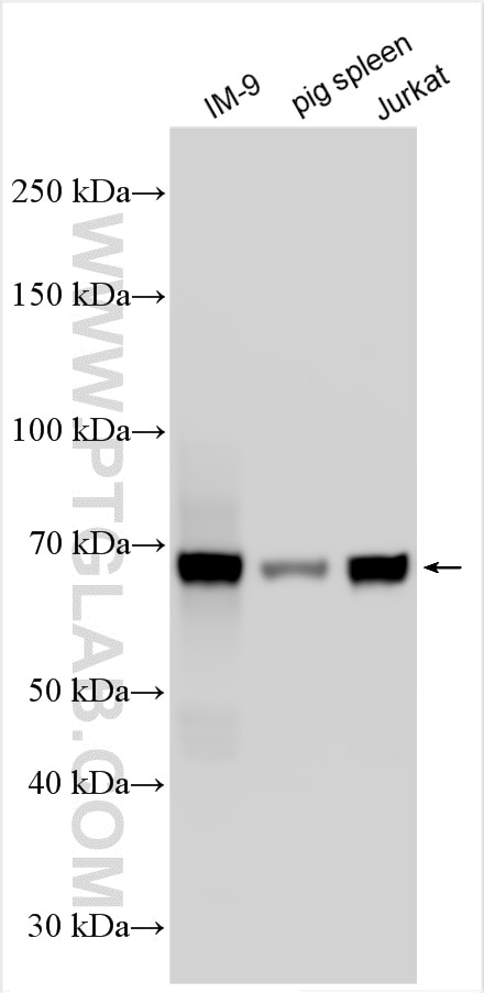 Western Blot (WB) analysis of various lysates using SLAMF7/CD319 Polyclonal antibody (12905-1-AP)