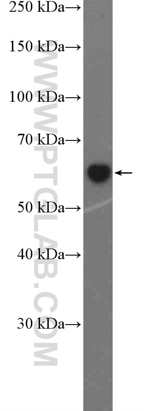 Western Blot (WB) analysis of human spleen tissue using SLAMF7/CD319 Polyclonal antibody (12905-1-AP)