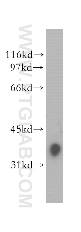 SLAMF7/CD319