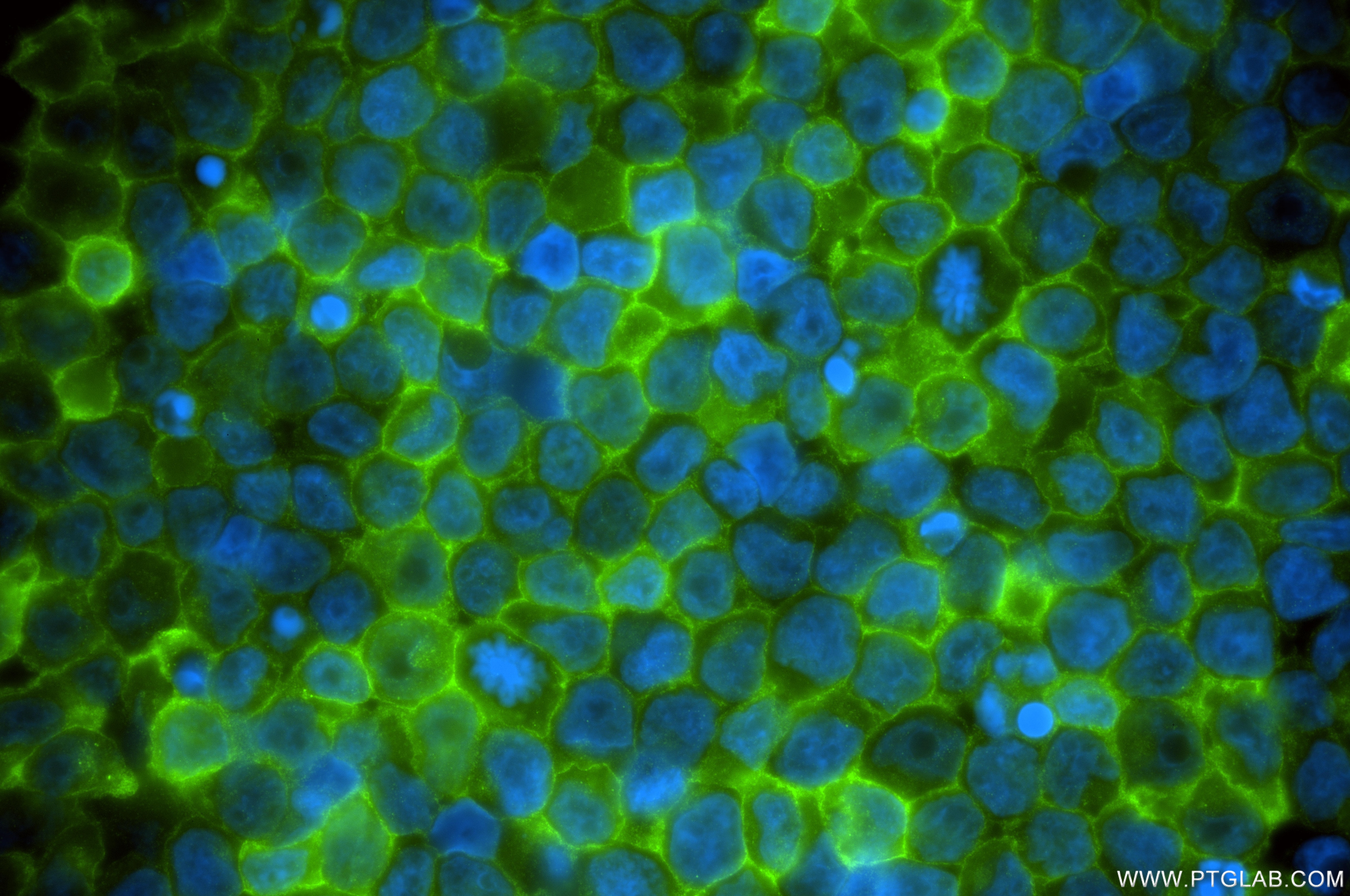 Immunofluorescence (IF) / fluorescent staining of IM-9 cells using SLAMF7/CD319 Recombinant monoclonal antibody (84254-1-RR)