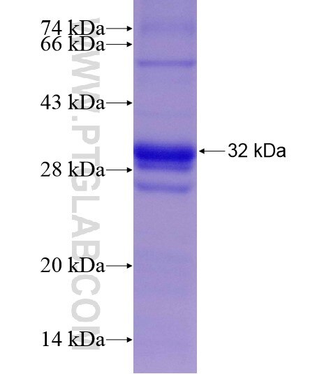 SLC10A2 fusion protein Ag18808 SDS-PAGE