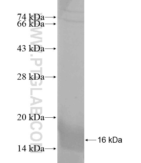 SLC10A2 fusion protein Ag18873 SDS-PAGE