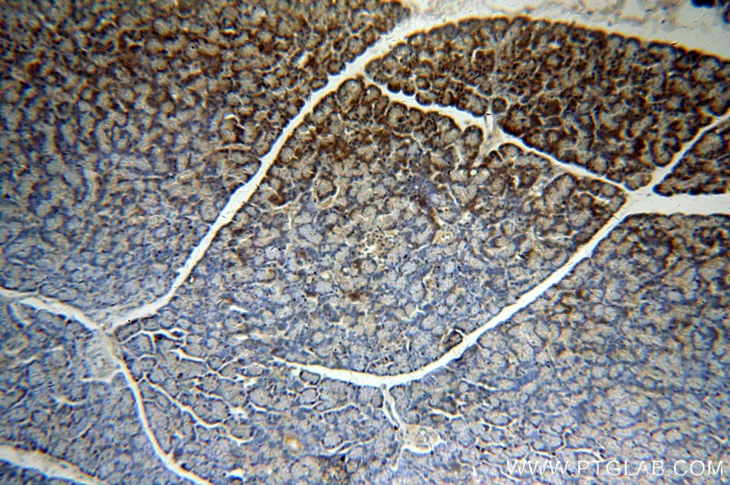 Immunohistochemistry (IHC) staining of human pancreas tissue using SLC10A3 Polyclonal antibody (19909-1-AP)