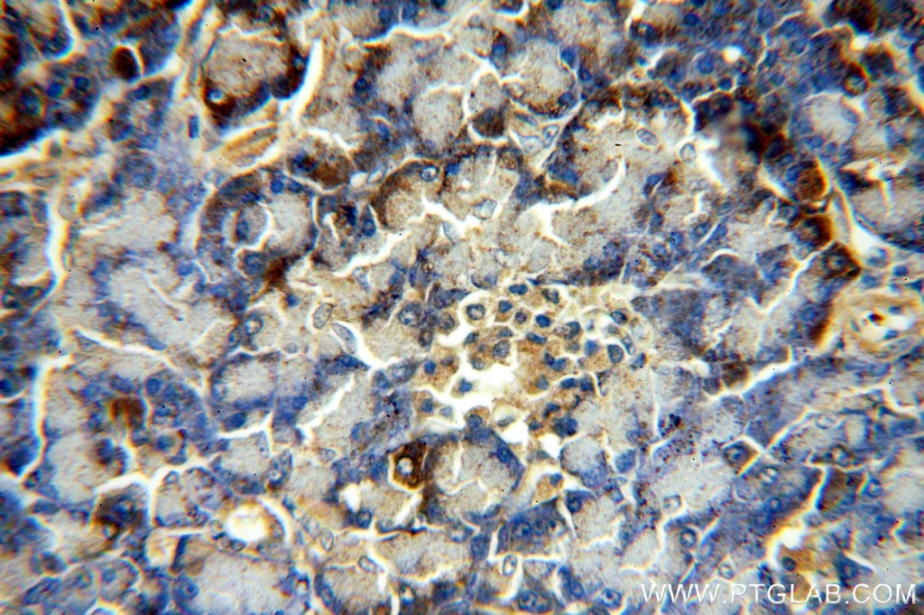 Immunohistochemistry (IHC) staining of human pancreas tissue using SLC10A3 Polyclonal antibody (19909-1-AP)