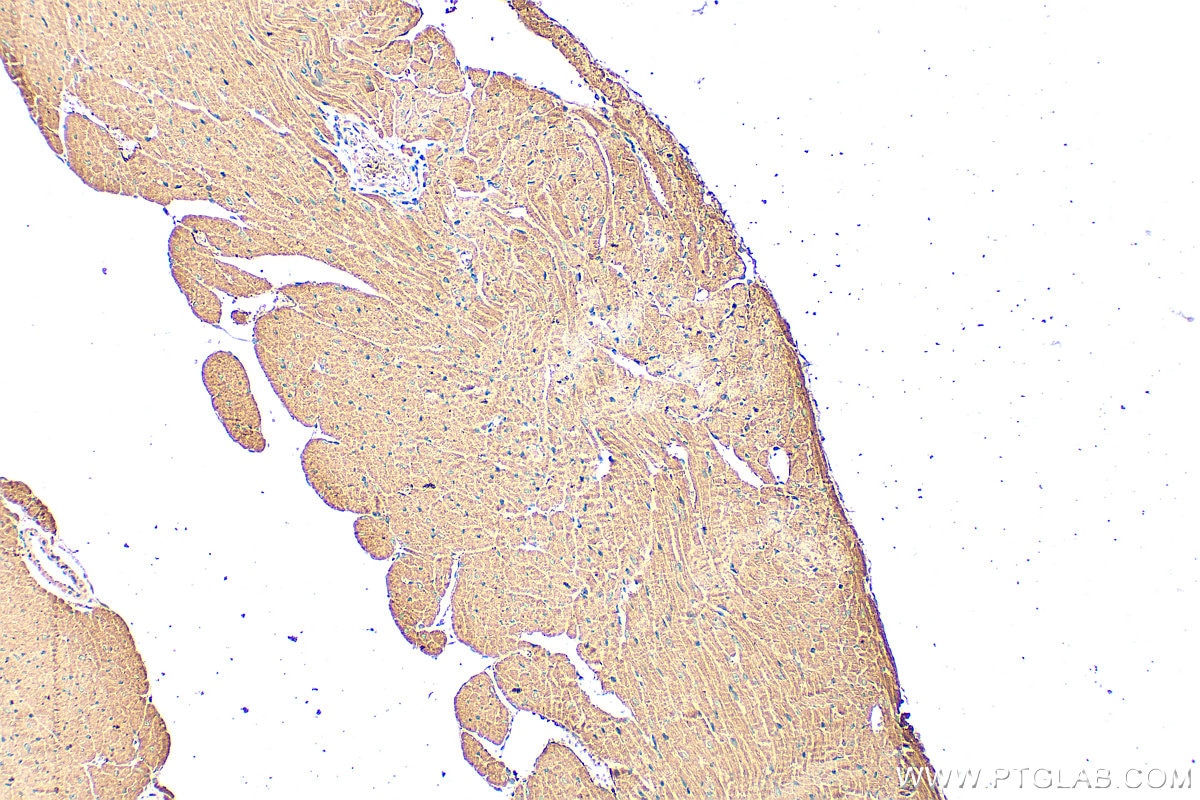 Immunohistochemistry (IHC) staining of mouse heart tissue using SLC10A5 Polyclonal antibody (25597-1-AP)