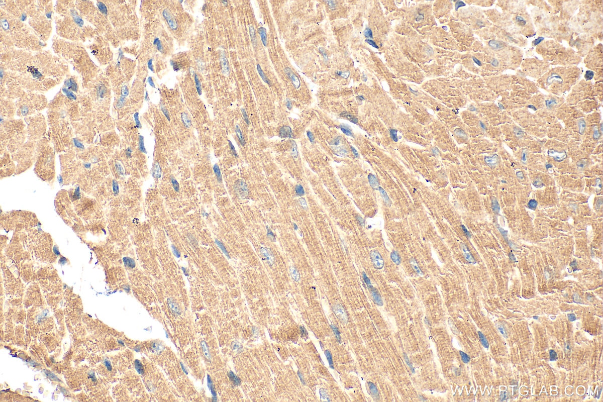 Immunohistochemistry (IHC) staining of mouse heart tissue using SLC10A5 Polyclonal antibody (25597-1-AP)