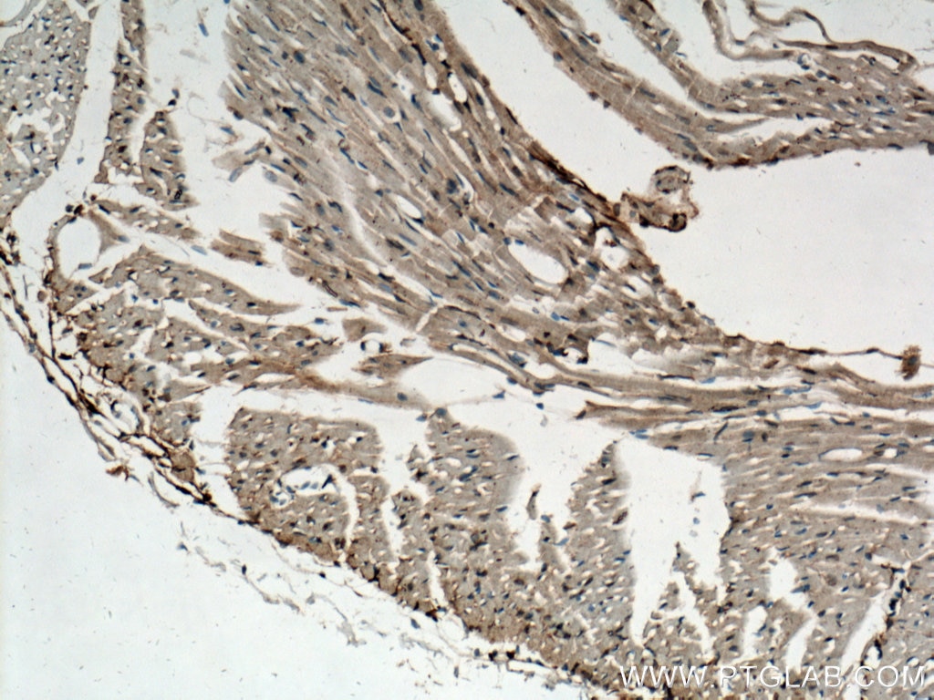 Immunohistochemistry (IHC) staining of mouse heart tissue using SLC10A6 Polyclonal antibody (27938-1-AP)