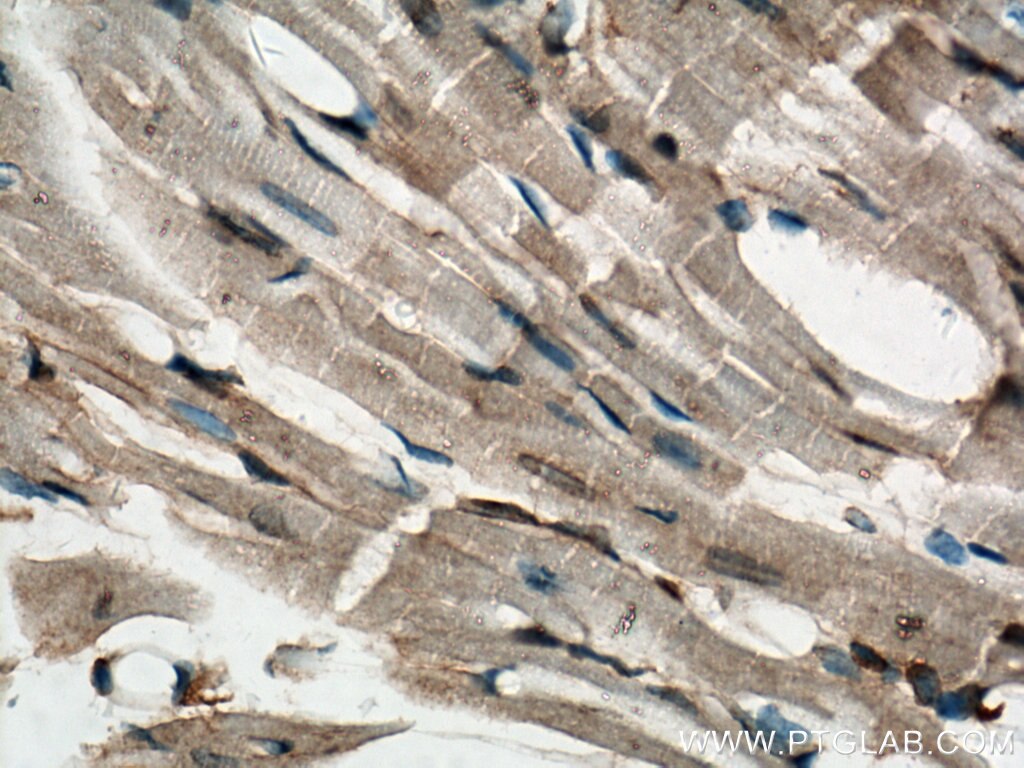 Immunohistochemistry (IHC) staining of mouse heart tissue using SLC10A6 Polyclonal antibody (27938-1-AP)