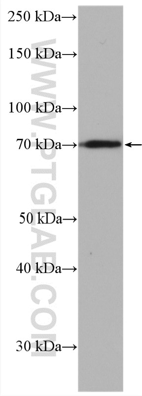 Western Blot (WB) analysis of mouse liver tissue using SLC10A6 Polyclonal antibody (27938-1-AP)