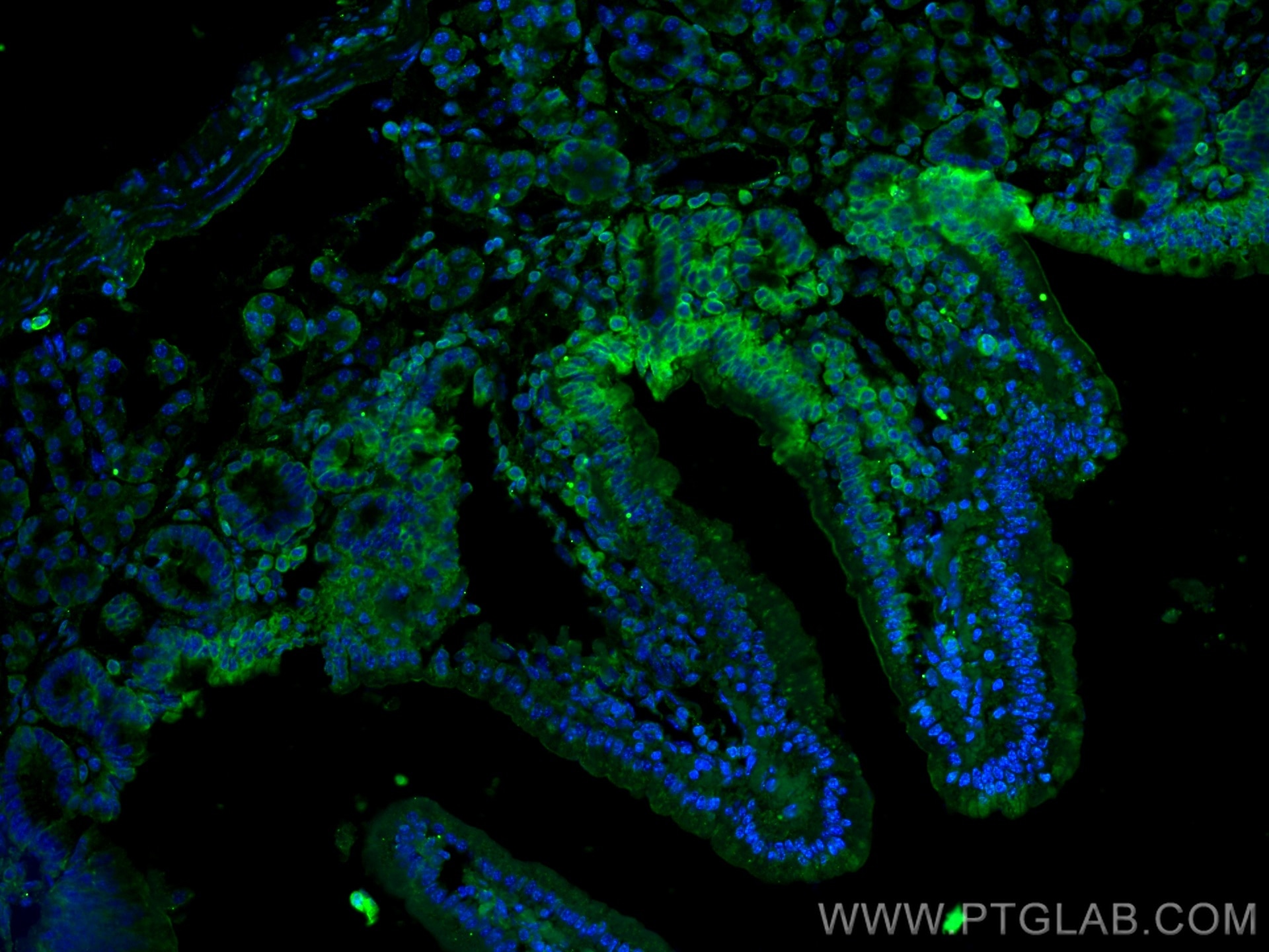 Immunofluorescence (IF) / fluorescent staining of mouse small intestine tissue using DMT1 Polyclonal antibody (20507-1-AP)