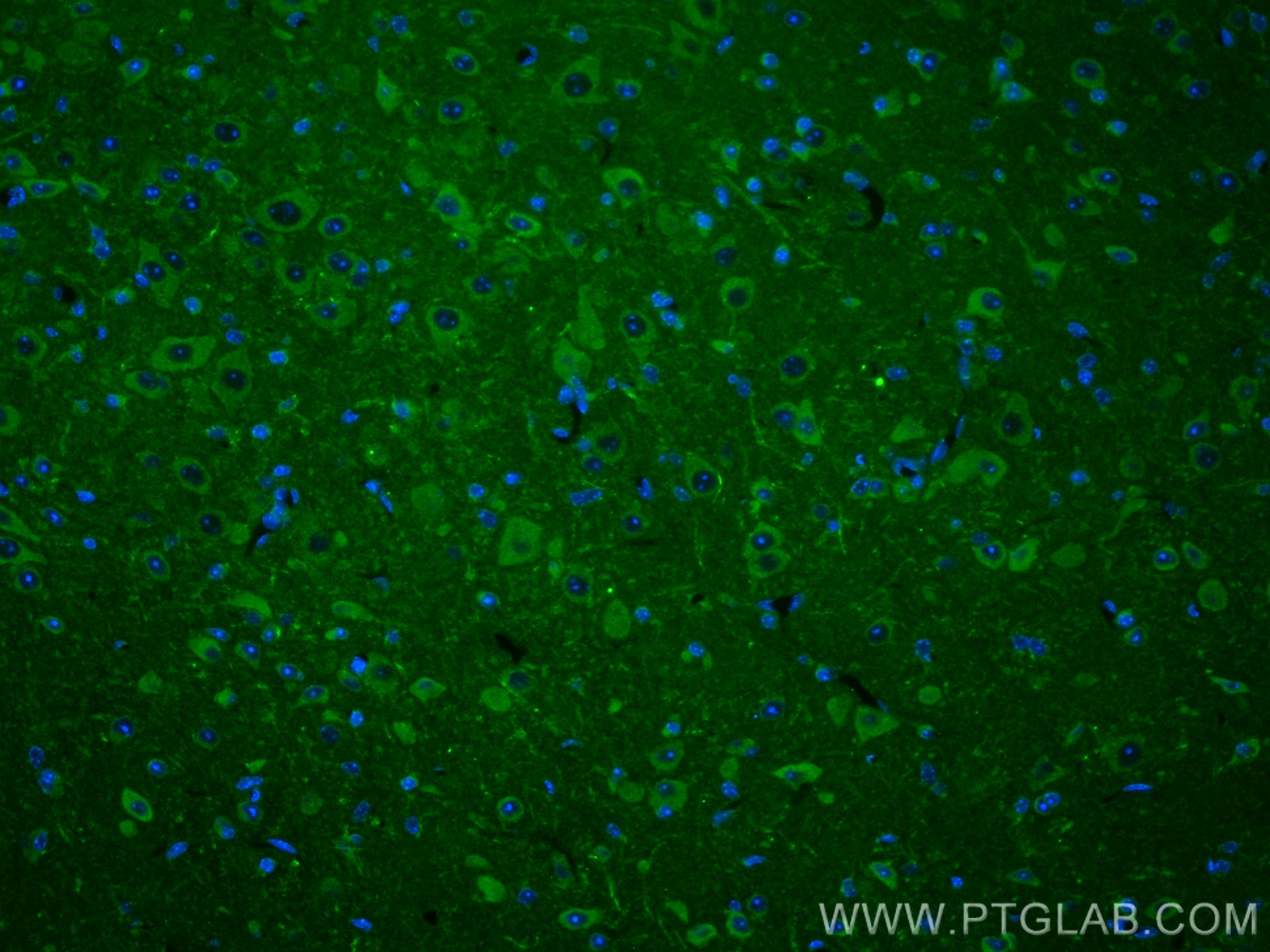 Immunofluorescence (IF) / fluorescent staining of mouse brain tissue using DMT1 Polyclonal antibody (20507-1-AP)