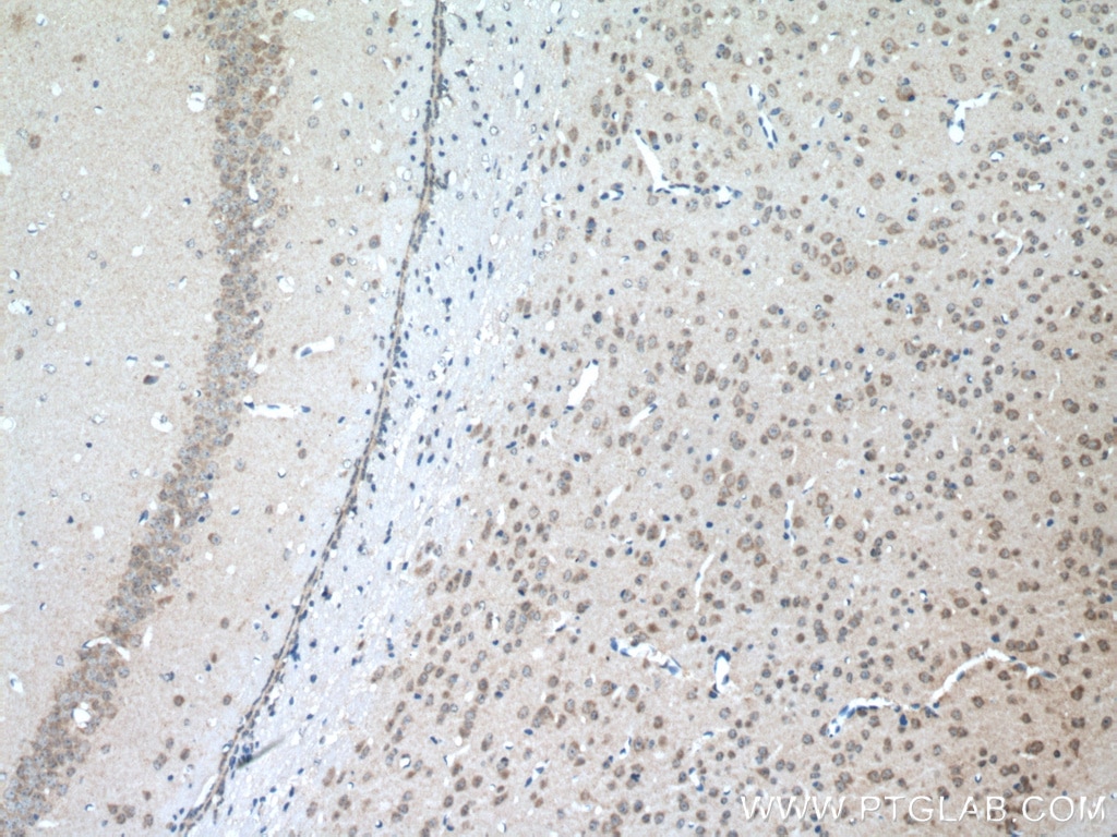 IHC staining of mouse brain using 20507-1-AP