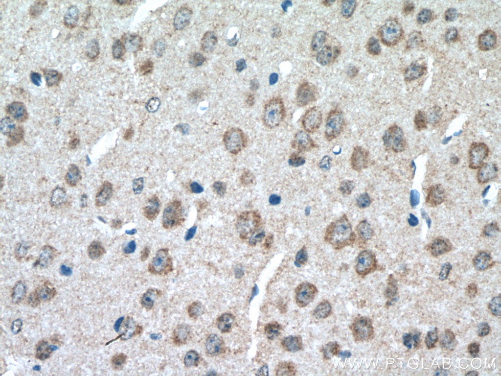 Immunohistochemistry (IHC) staining of mouse brain tissue using DMT1 Polyclonal antibody (20507-1-AP)