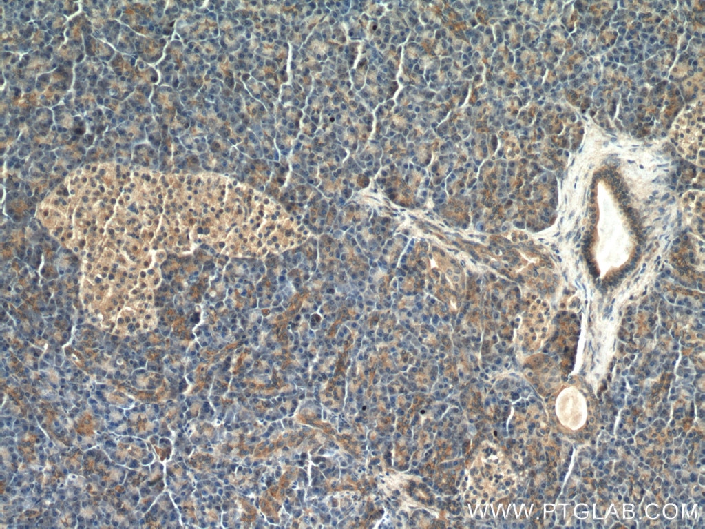 Immunohistochemistry (IHC) staining of human pancreas tissue using DMT1 Polyclonal antibody (20507-1-AP)