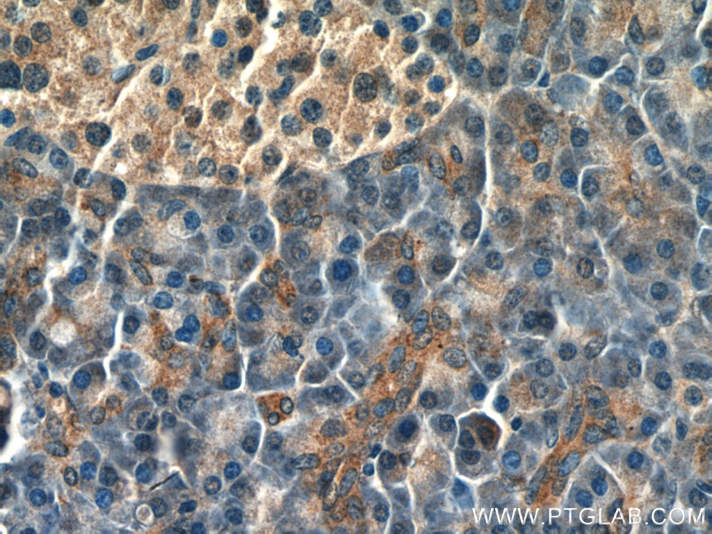 Immunohistochemistry (IHC) staining of human pancreas tissue using DMT1 Polyclonal antibody (20507-1-AP)