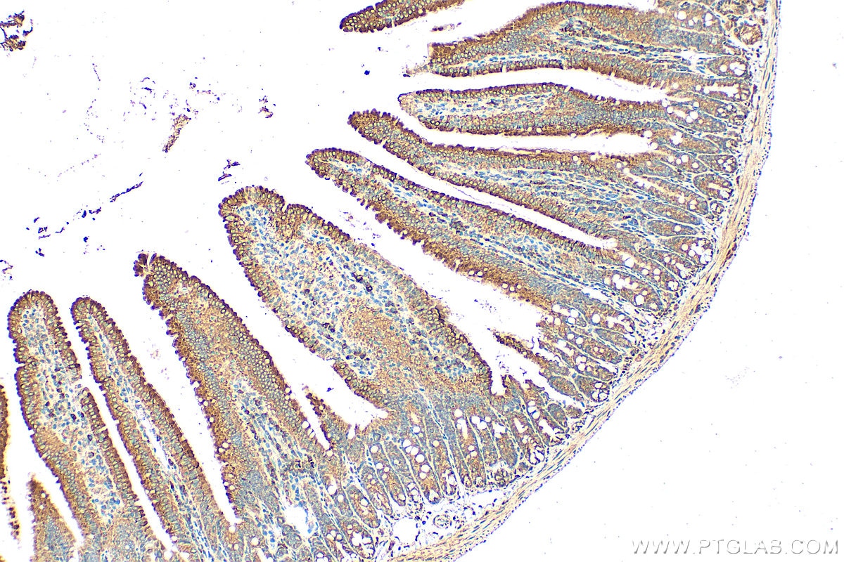 Immunohistochemical analysis of paraffin-embedded mouse small intestine tissue slide using 20507-1-AP (DMT1 antibody) at dilution of 1:400 (under 10x lens). Heat mediated antigen retrieval with Tris-EDTA buffer (pH 9.0). Immunohistochemistry (IHC) staining of mouse small intestine tissue using DMT1 Polyclonal antibody (20507-1-AP)
