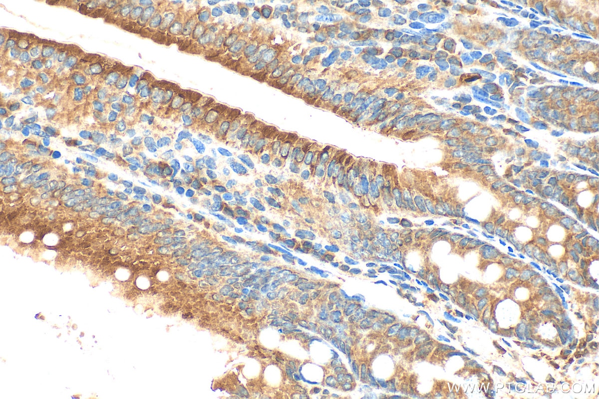 Immunohistochemical analysis of paraffin-embedded mouse small intestine tissue slide using 20507-1-AP (DMT1 antibody) at dilution of 1:400 (under 40x lens). Heat mediated antigen retrieval with Tris-EDTA buffer (pH 9.0). Immunohistochemistry (IHC) staining of mouse small intestine tissue using DMT1 Polyclonal antibody (20507-1-AP)