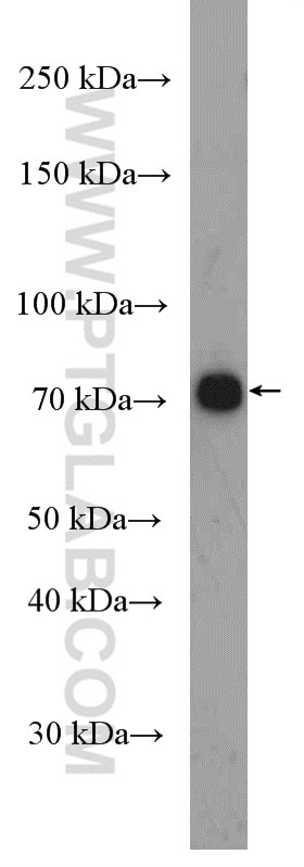 Western Blot (WB) analysis of Neuro-2a cells using DMT1 Polyclonal antibody (20507-1-AP)