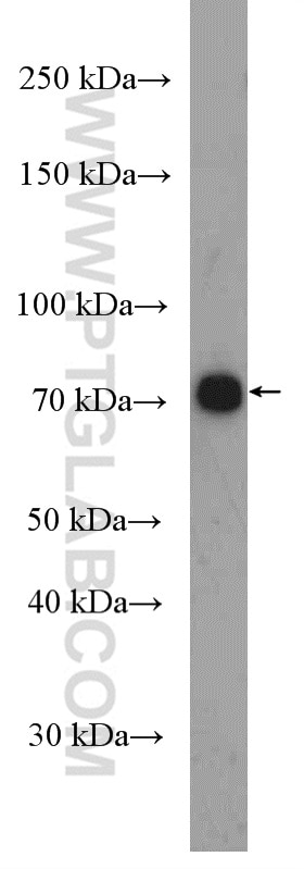 WB analysis of Neuro-2a using 20507-1-AP