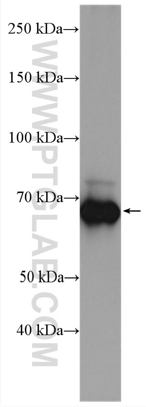 Western Blot (WB) analysis of COLO 320 cells using DMT1 Polyclonal antibody (20507-1-AP)