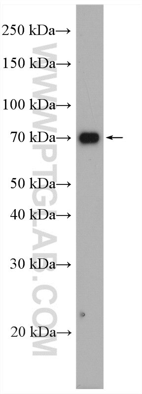 Western Blot (WB) analysis of rat kidney tissue using DMT1 Polyclonal antibody (20507-1-AP)