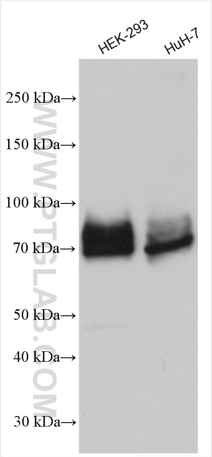 Western Blot (WB) analysis of various lysates using DMT1 Polyclonal antibody (20507-1-AP)