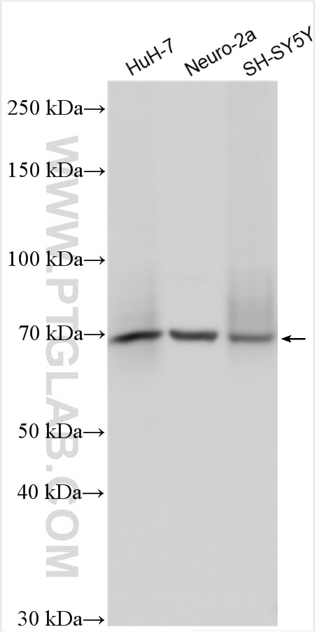 Western Blot (WB) analysis of various lysates using DMT1 Polyclonal antibody (20507-1-AP)