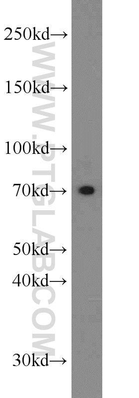 Western Blot (WB) analysis of SH-SY5Y cells using DMT1 Polyclonal antibody (20507-1-AP)