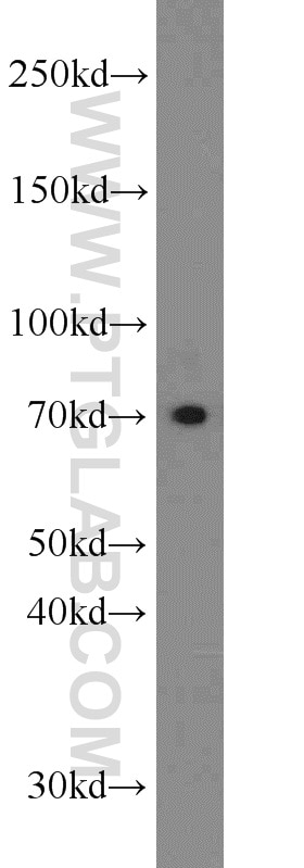 WB analysis of SH-SY5Y using 20507-1-AP