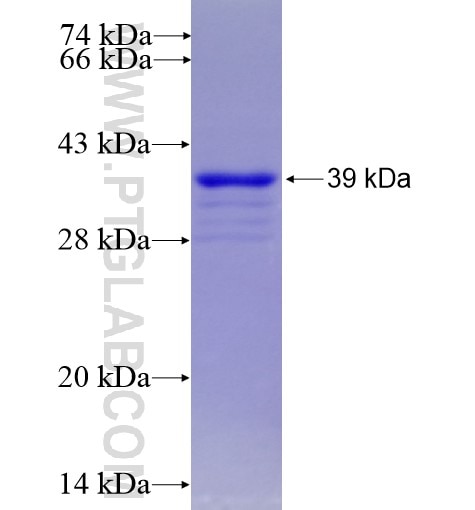 SLC11A2 fusion protein Ag14314 SDS-PAGE