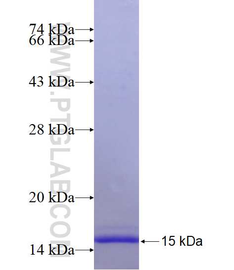 SLC11A2 fusion protein Ag16824 SDS-PAGE