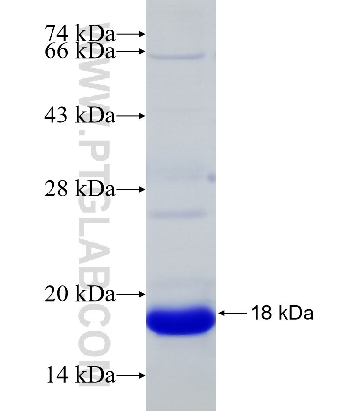 SLC11A2 fusion protein Ag16824 SDS-PAGE