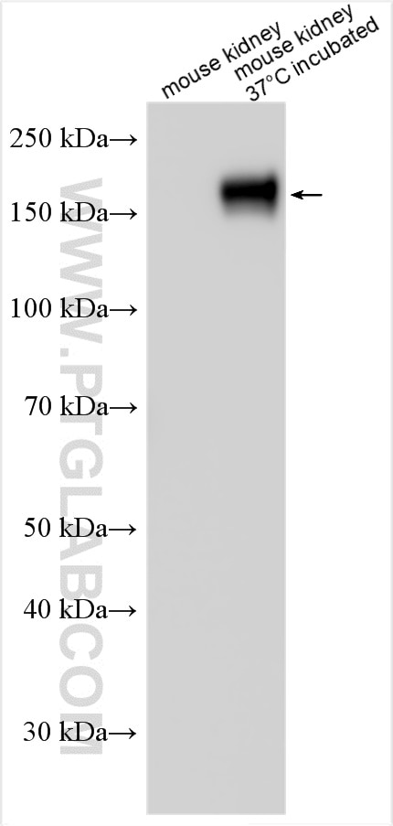 Western Blot (WB) analysis of various lysates using NKCC2 Polyclonal antibody (13636-1-AP)