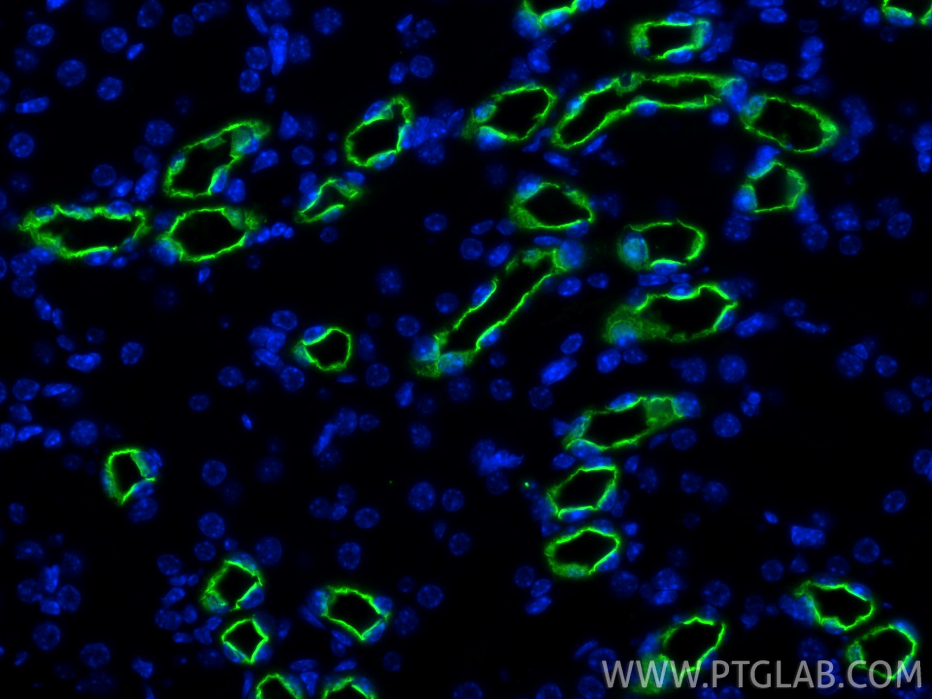 Immunofluorescence (IF) / fluorescent staining of mouse kidney tissue using SLC12A1/NKCC2 Polyclonal antibody (18970-1-AP)