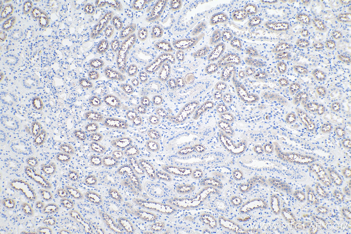 Immunohistochemistry (IHC) staining of human kidney tissue using NKCC2 Polyclonal antibody (18970-1-AP)