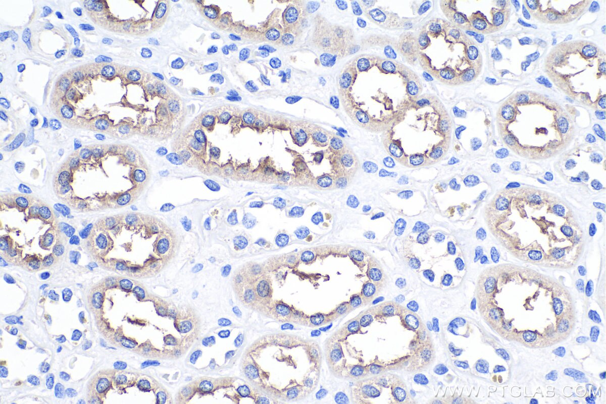 Immunohistochemistry (IHC) staining of human kidney tissue using NKCC2 Polyclonal antibody (18970-1-AP)