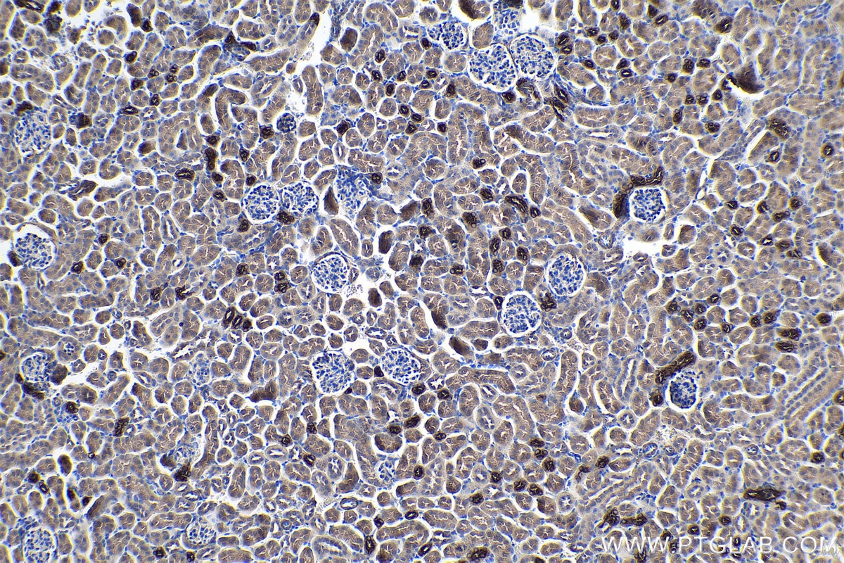 Immunohistochemistry (IHC) staining of mouse kidney tissue using NKCC2 Polyclonal antibody (18970-1-AP)