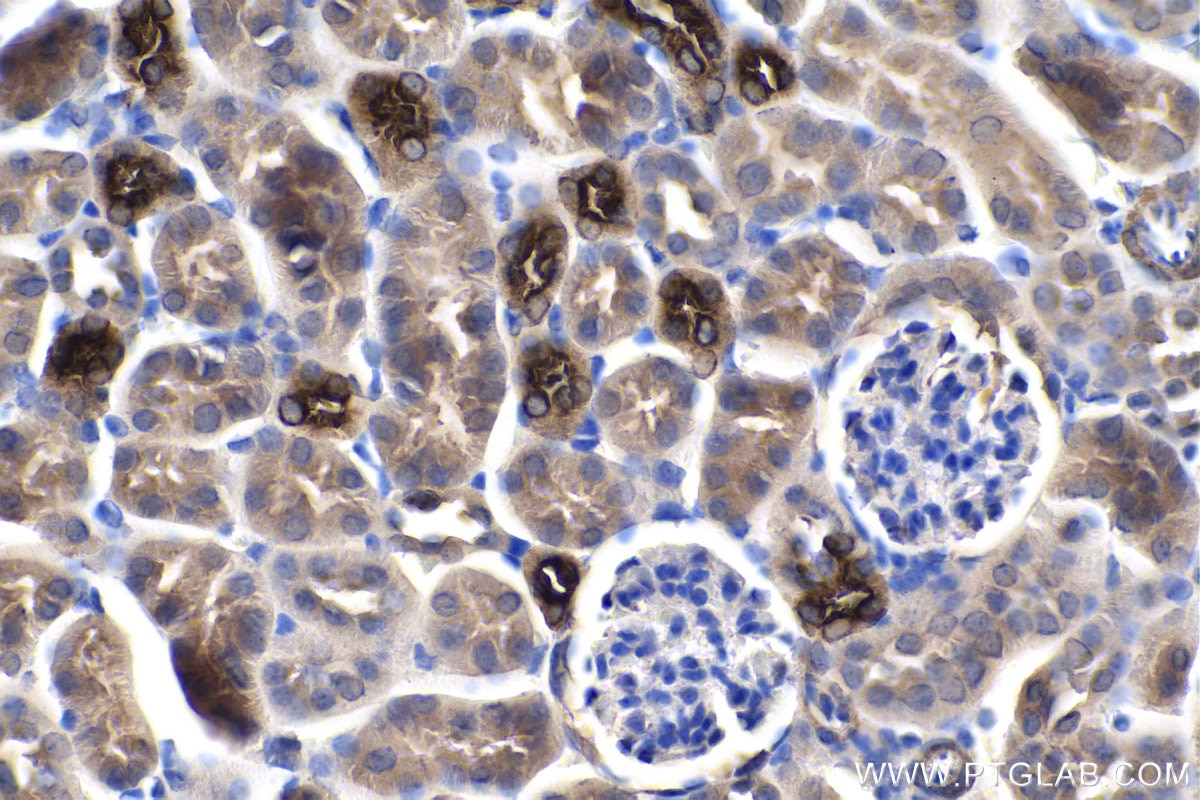 IHC staining of mouse kidney using 18970-1-AP
