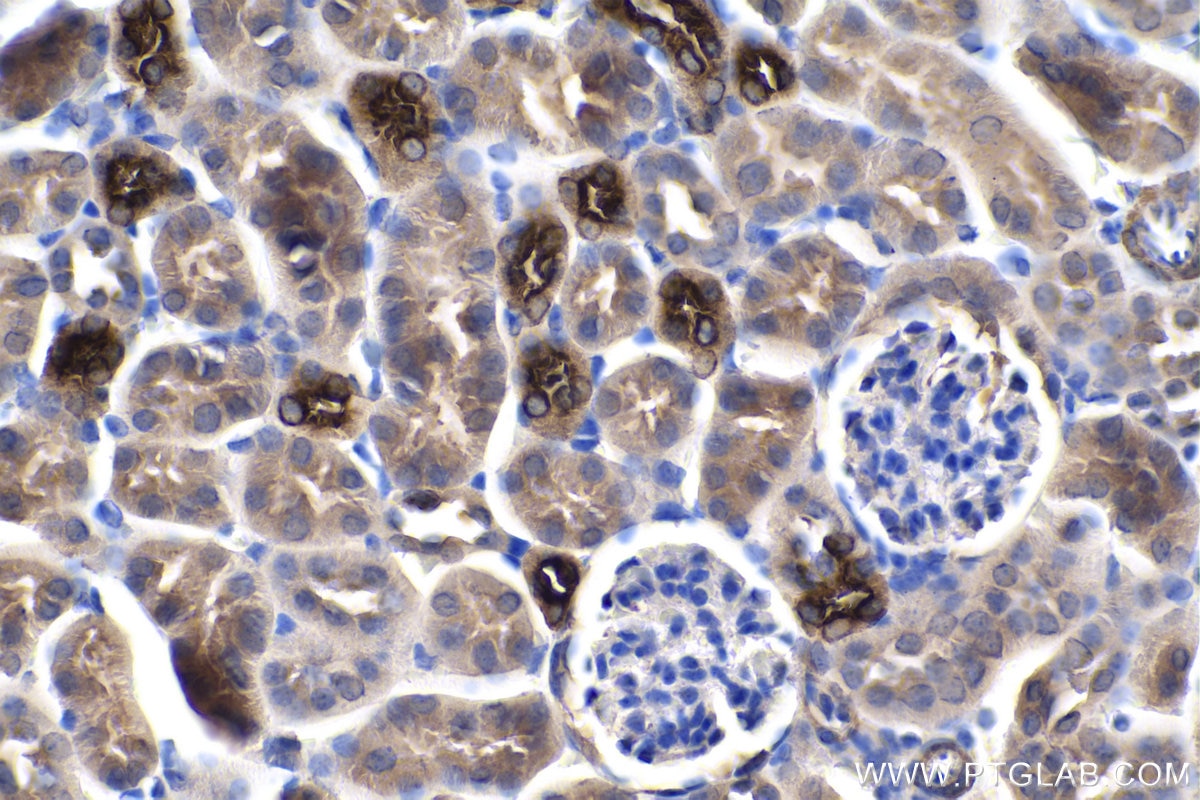 Immunohistochemistry (IHC) staining of mouse kidney tissue using NKCC2 Polyclonal antibody (18970-1-AP)