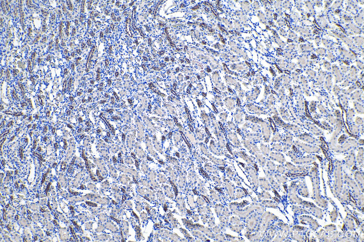 Immunohistochemistry (IHC) staining of rat kidney tissue using NKCC2 Polyclonal antibody (18970-1-AP)