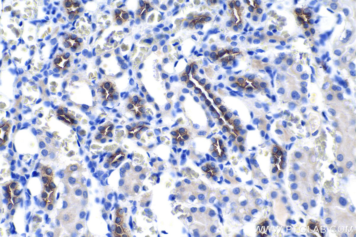 Immunohistochemistry (IHC) staining of rat kidney tissue using NKCC2 Polyclonal antibody (18970-1-AP)