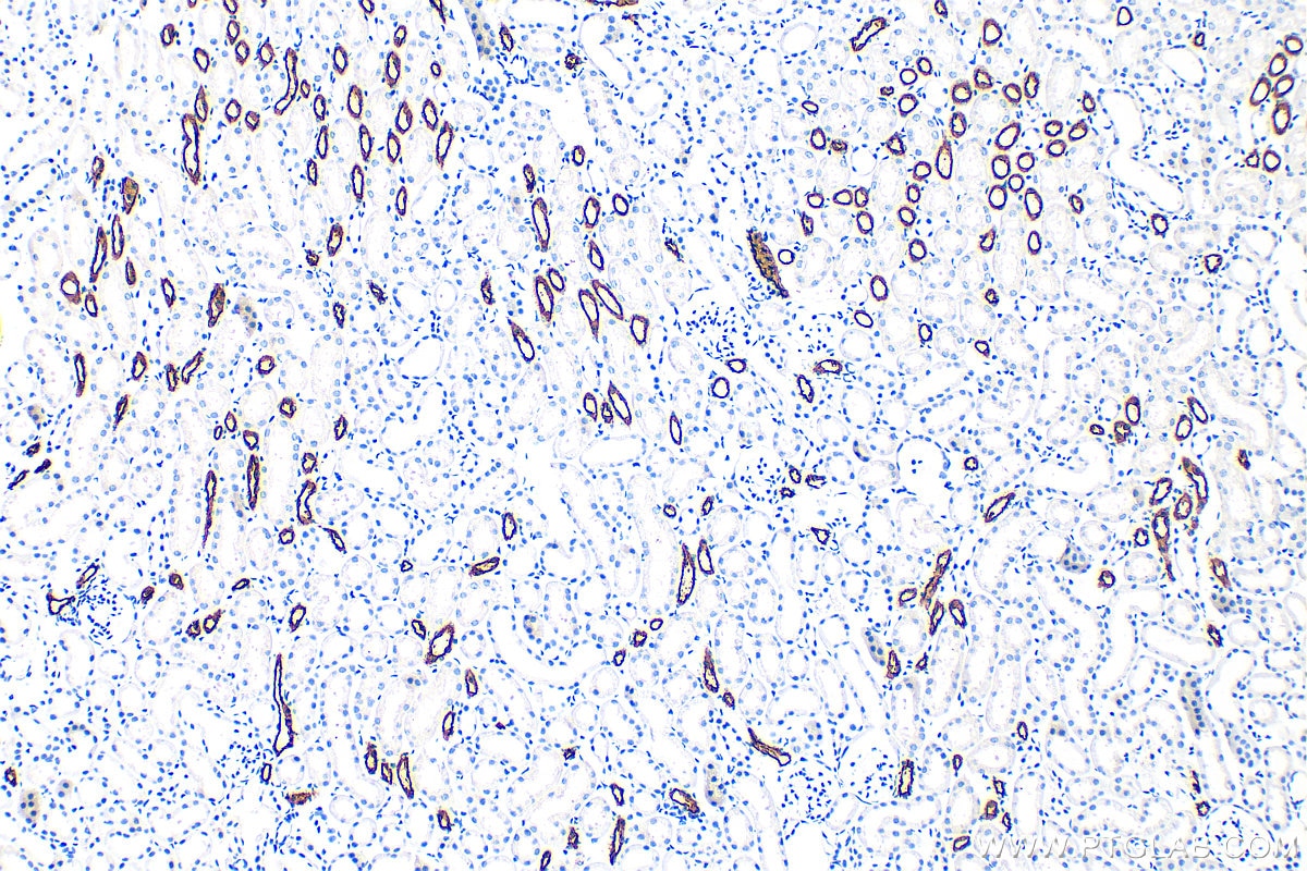 Immunohistochemistry (IHC) staining of mouse kidney tissue using SLC12A1/NKCC2 Polyclonal antibody (18970-1-AP)