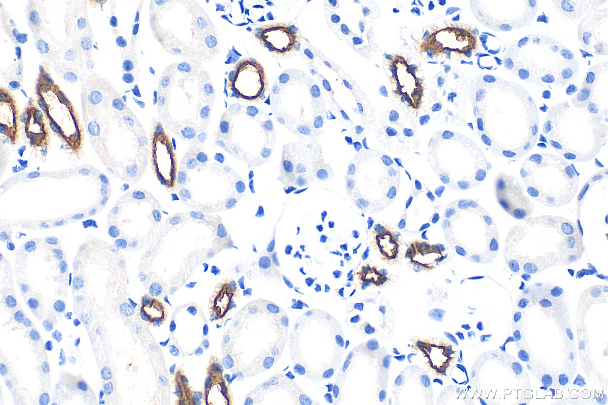 Immunohistochemistry (IHC) staining of mouse kidney tissue using SLC12A1/NKCC2 Polyclonal antibody (18970-1-AP)