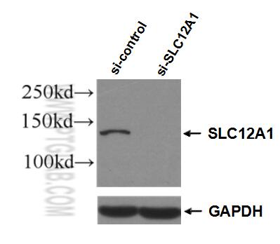 Western Blot (WB) analysis of HEK-293 cells using NKCC2 Polyclonal antibody (18970-1-AP)