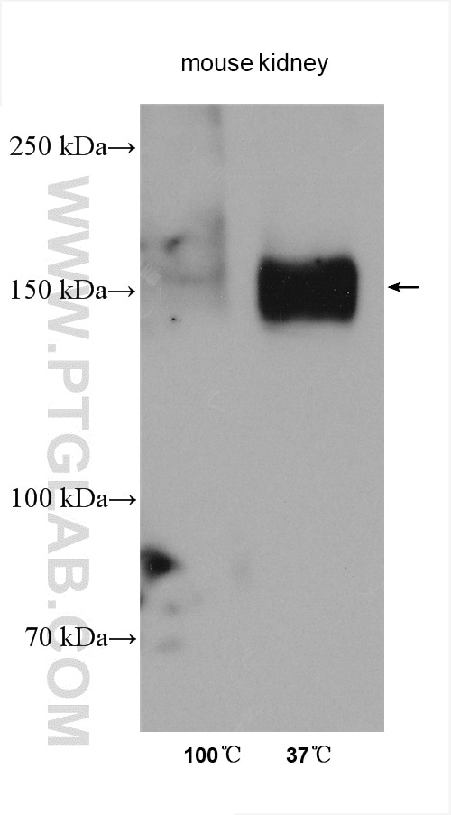 Western Blot (WB) analysis of various lysates using NKCC2 Polyclonal antibody (18970-1-AP)