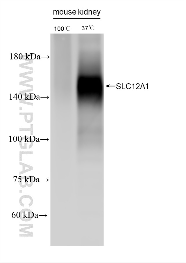Western Blot (WB) analysis of various lysates using SLC12A1 Recombinant monoclonal antibody (87210-1-RR)